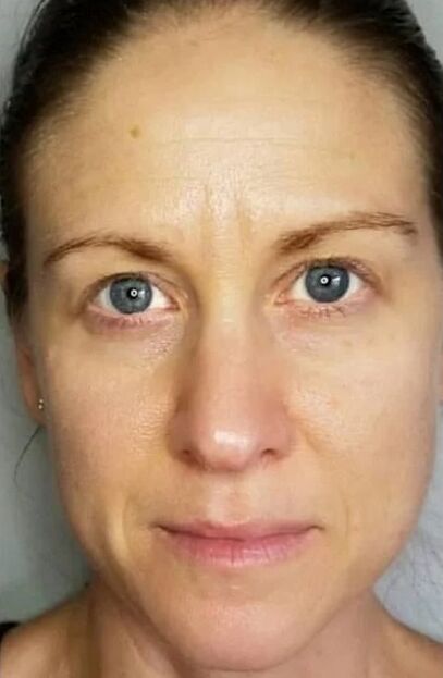 Simpla 360 hat dazu beigetragen, die Haut zu verjüngen und Flecken aufzuhellen